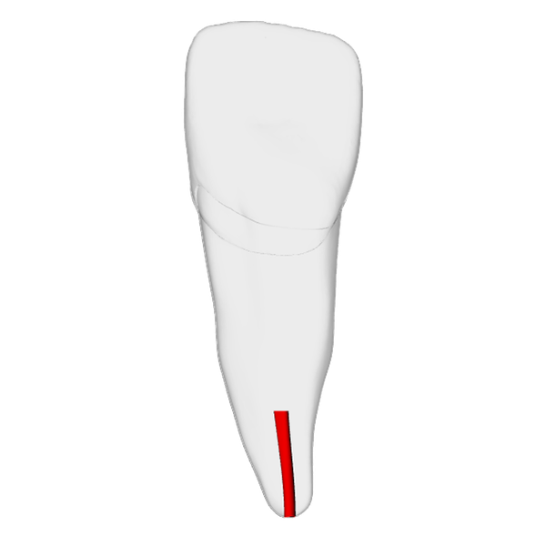 Incisor – Obliterated