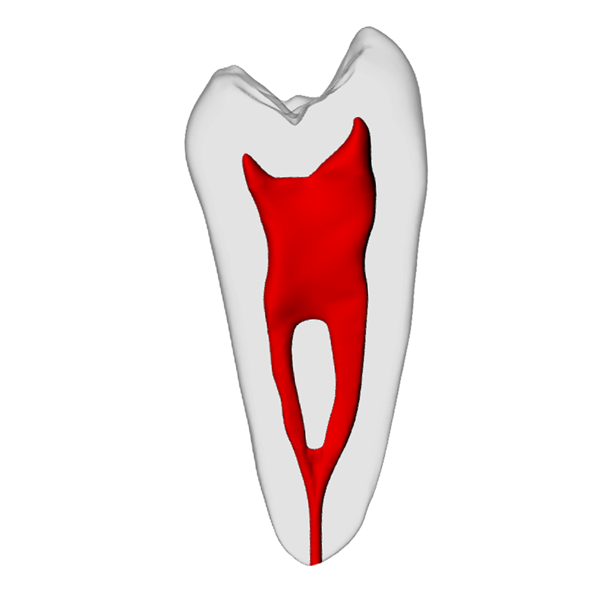 Premolar – Merging canals, Radiopaque (White) – DRSK Group AB, Demomodelle