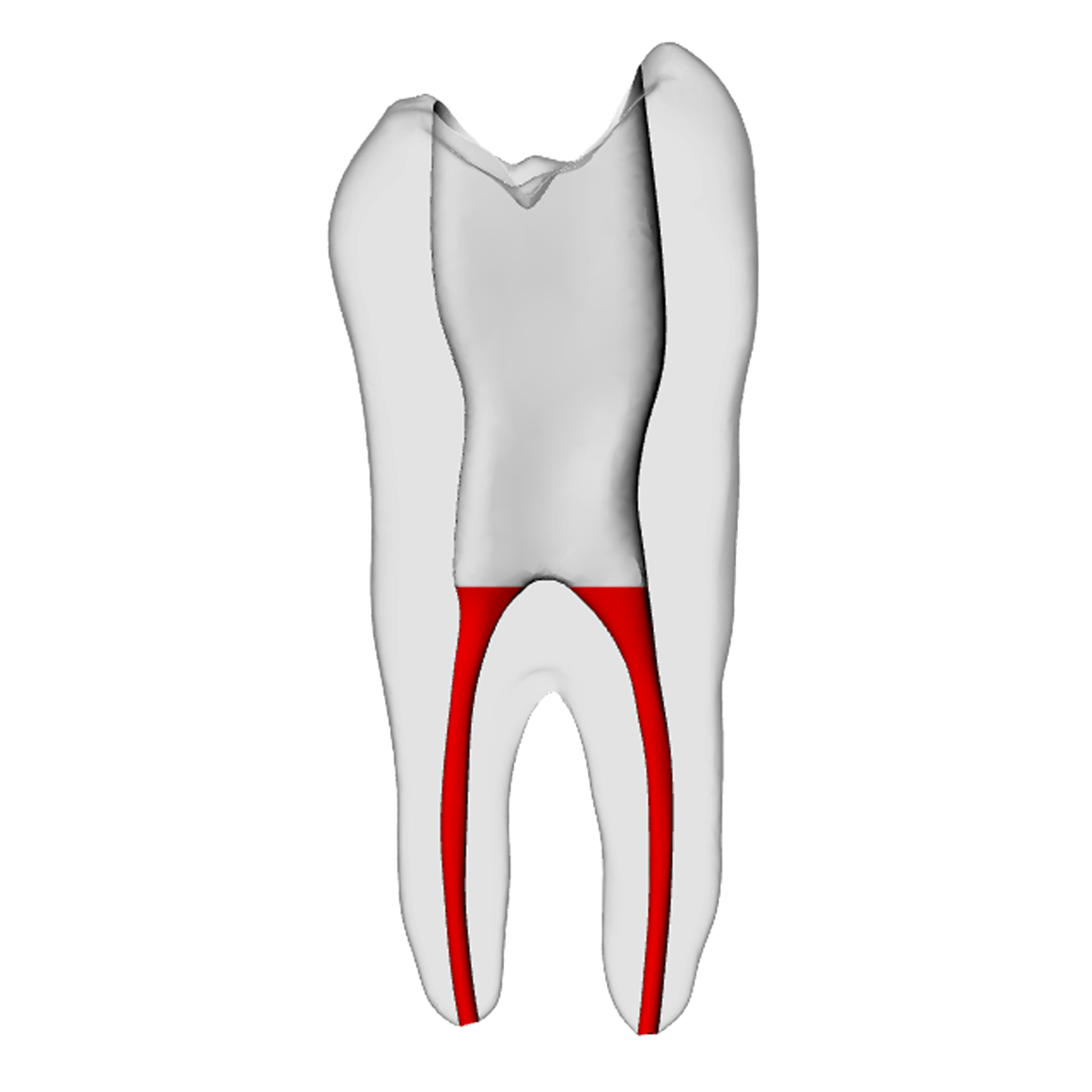 Premolar – Accessed, Basic, Radiopaque (White) – DRSK Group AB, Zubehör für Wurzelbehandlung