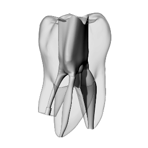 Molar, Perforated, Radiopaque (White)