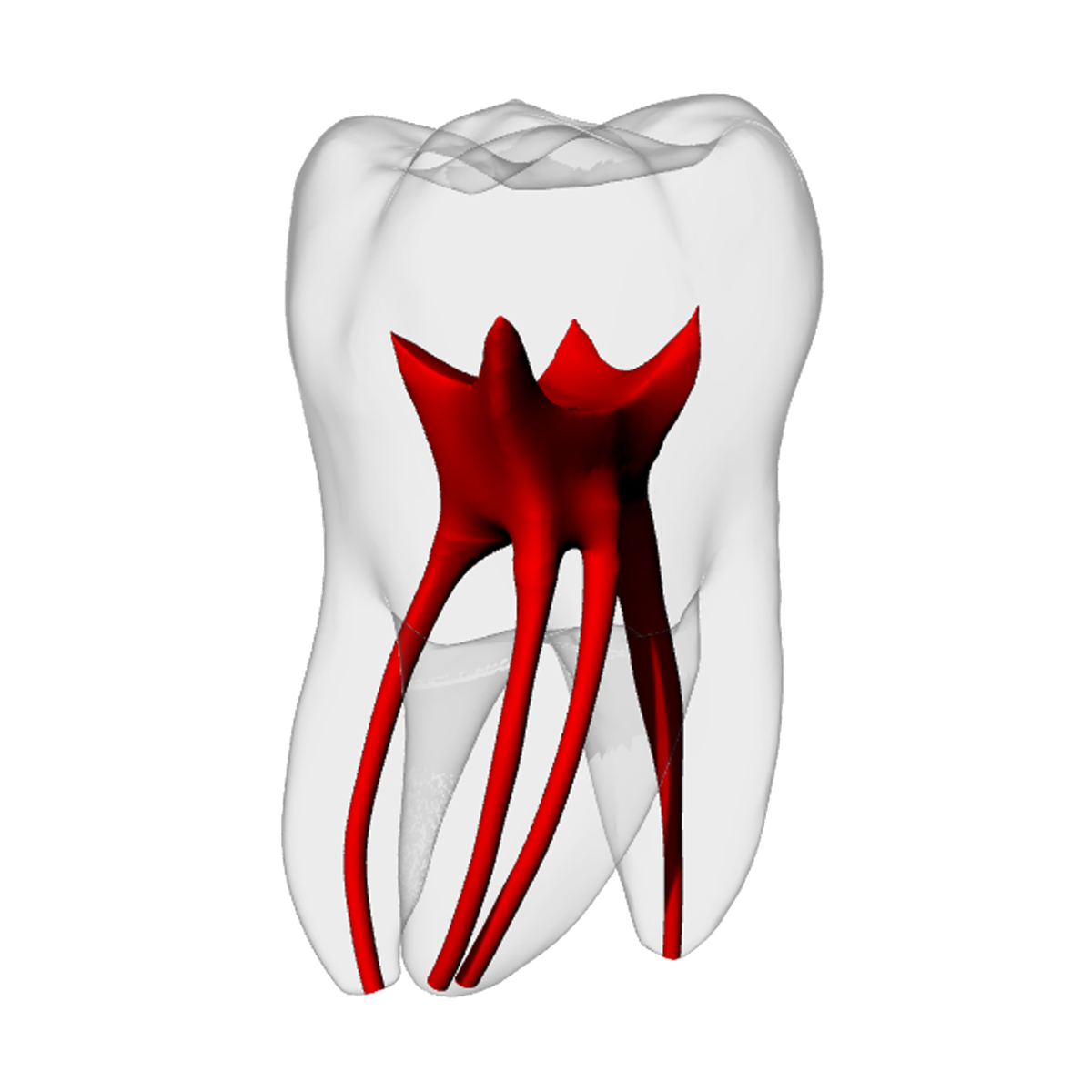 Molar – MB2, Radiopaque (White) – DRSK Group AB, Demomodelle