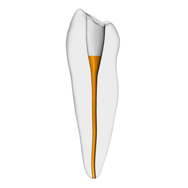 Premolar – Gutta percha, White