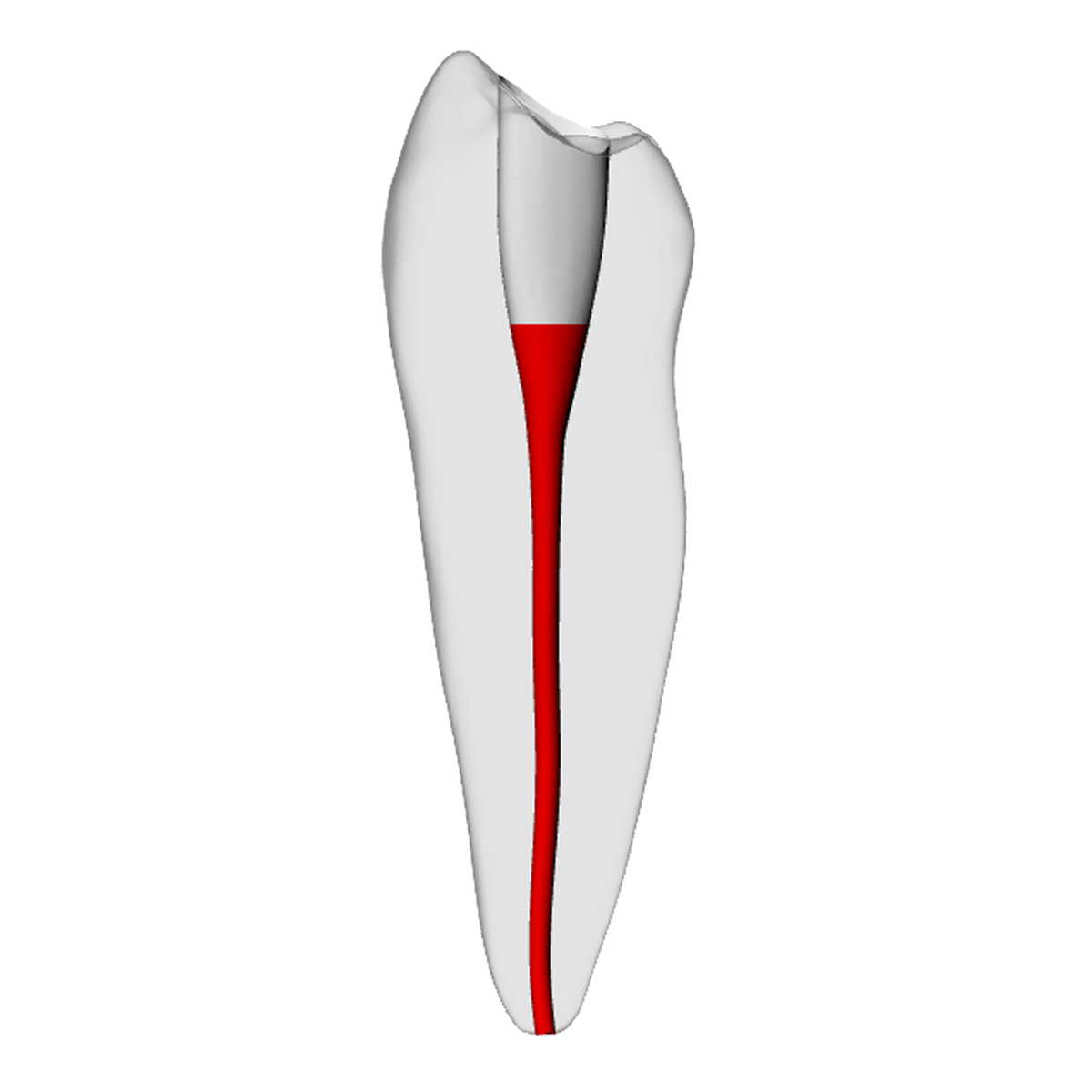 Premolar – Accessed, Basic, Clear, ~20# – DRSK Group AB, Gipszusätze, Stumpflacke und Gipslöser