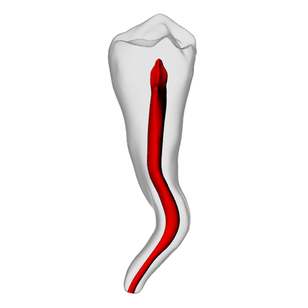 Premolar – Dilacerated, Radiopaque (White) – DRSK Group AB, Zubehör für Wurzelbehandlung