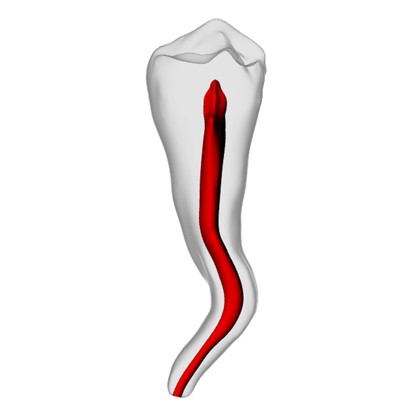 Premolar – Dilacerated, Radiopaque (White)