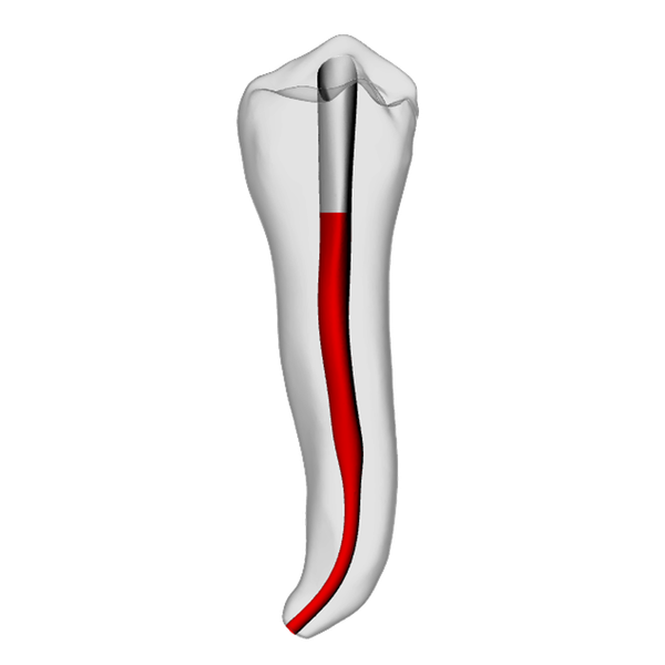 Premolar – Accessed, Apical curve, White