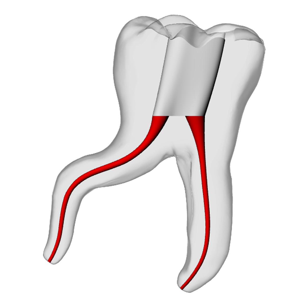 Molar – Severe Curvature 1, Clear – DRSK Group AB, Zubehör für Wurzelbehandlung
