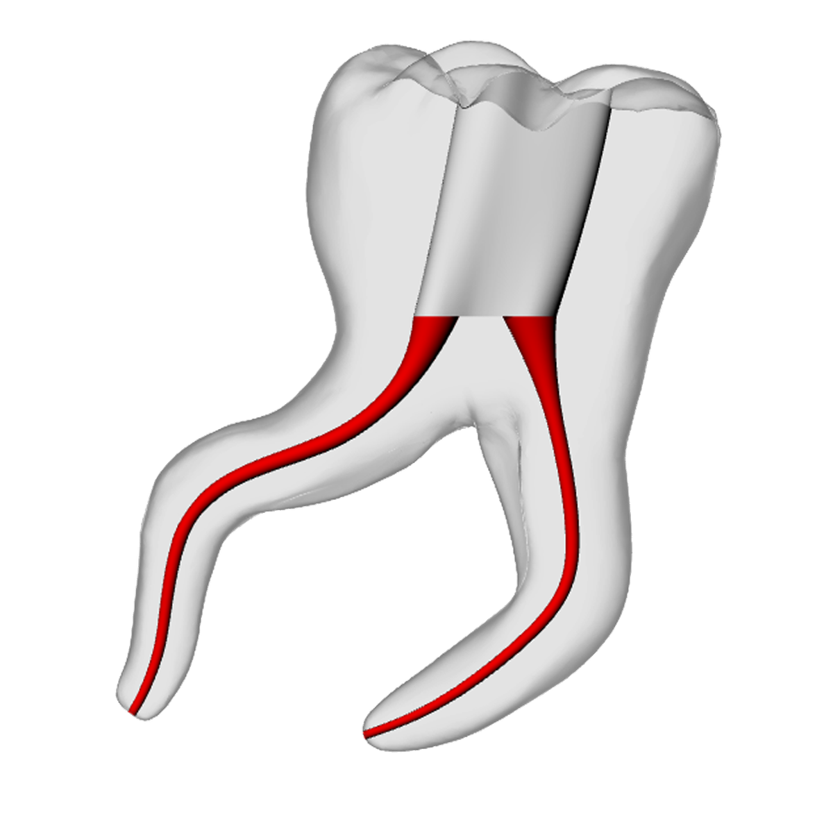 Molar – Severe Curvature 2, Clear – DRSK Group AB, Zubehör für Wurzelbehandlung