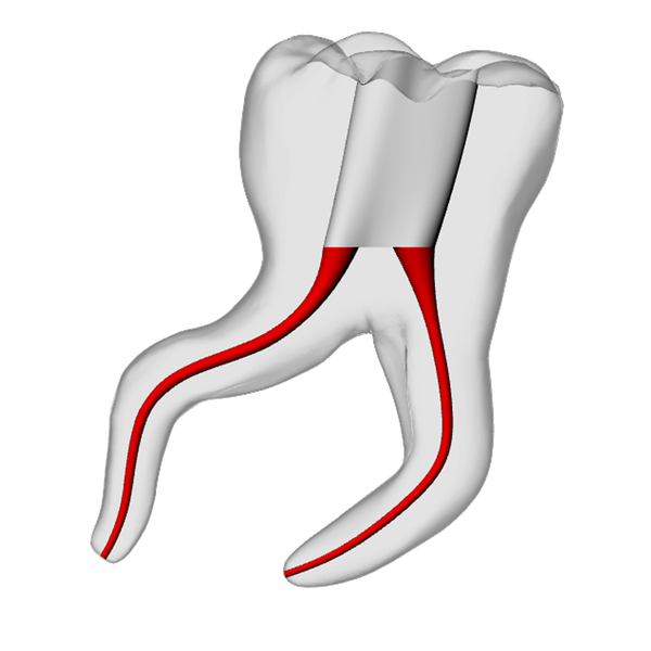 Molar – Severe Curvature 2, Clear