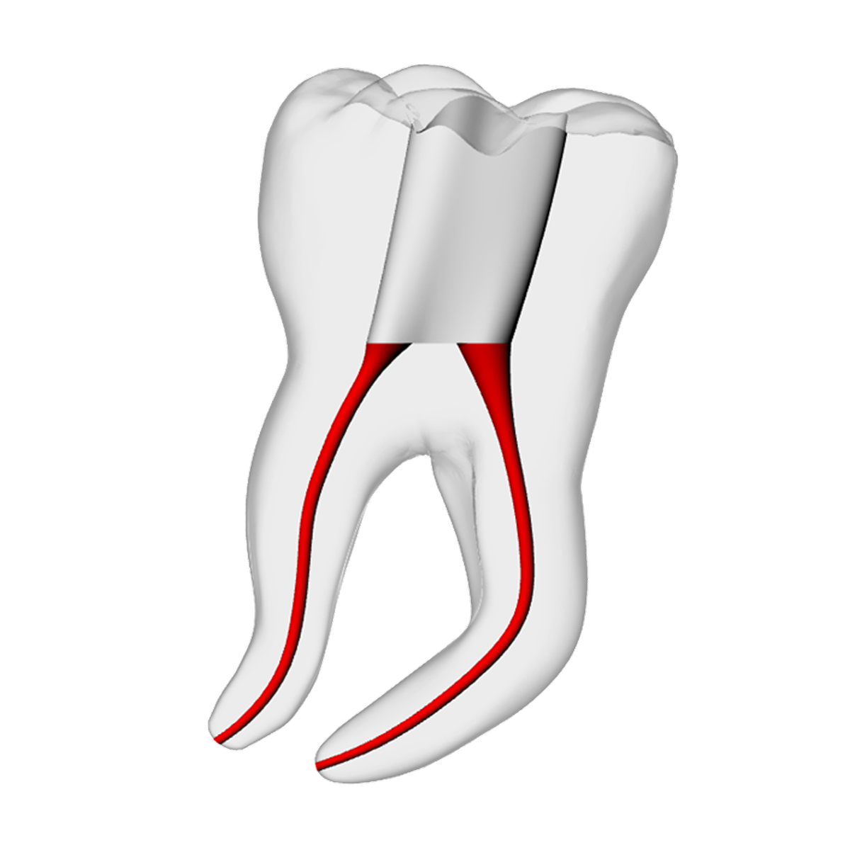 Molar – Severe Curvature 3, Clear – DRSK Group AB, Gipszusätze, Stumpflacke und Gipslöser