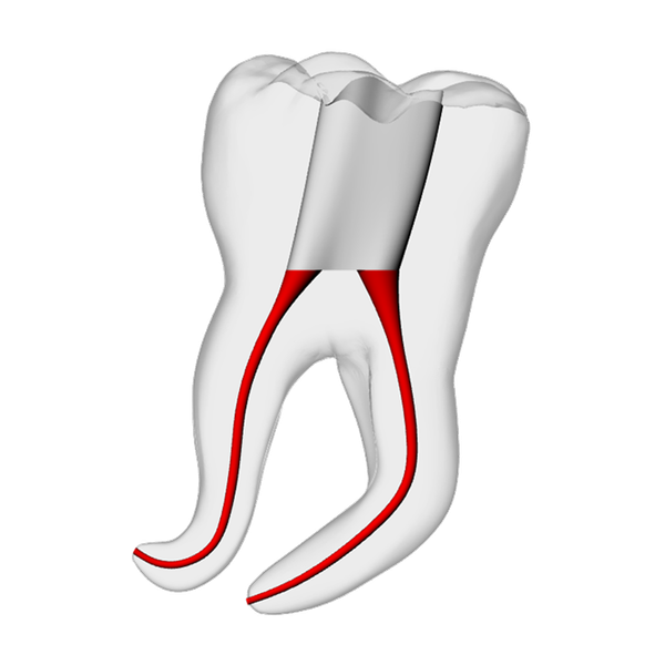 Molar – Severe Curvature 4, Clear