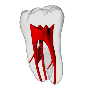 Molar – Accessory canals