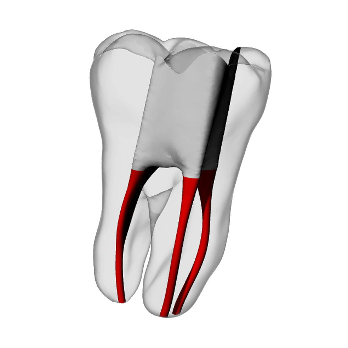 Molar – Accessed, Basic, Clear – DRSK Group AB, Demomodelle