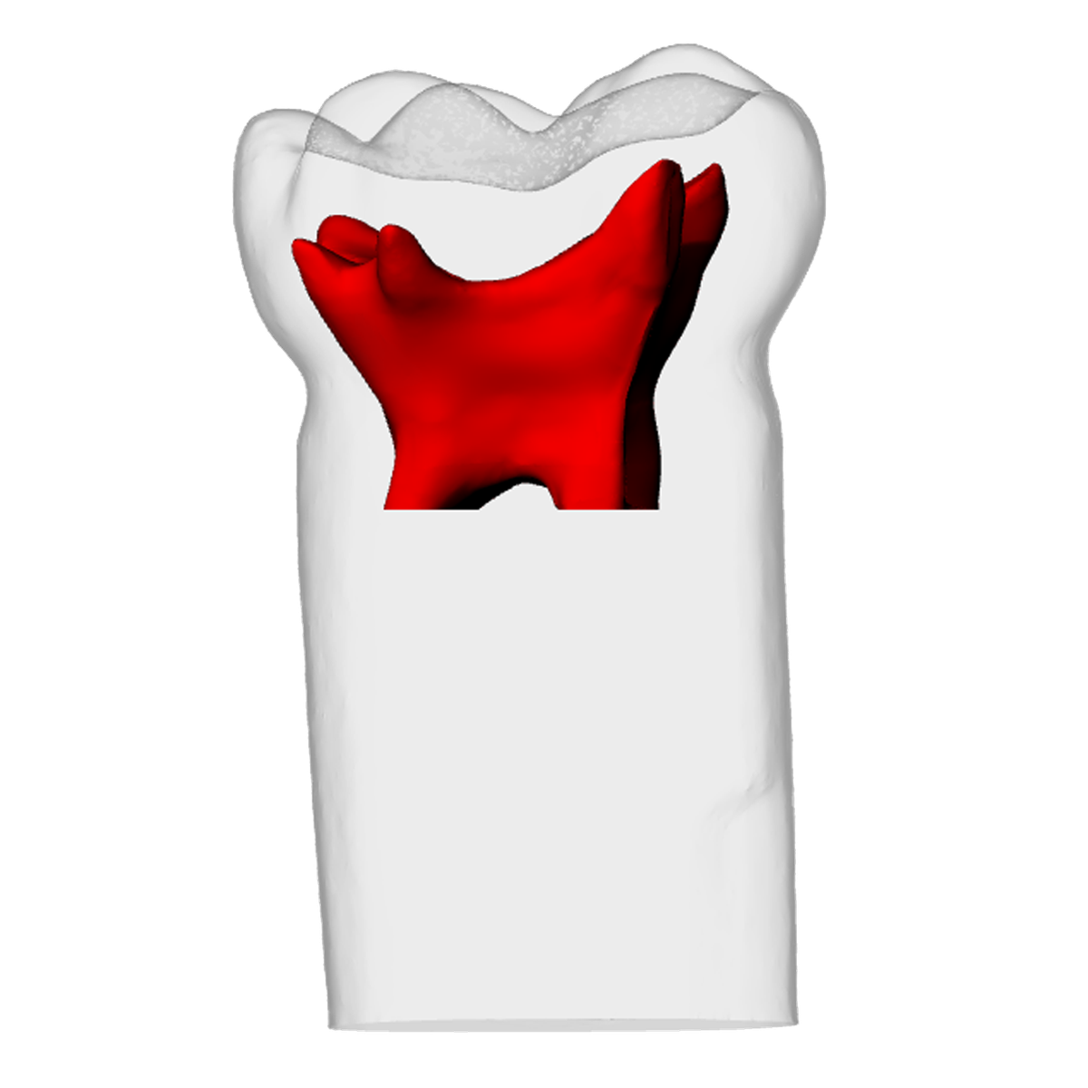 Primary maxillary second molar – DRSK Group AB, Geräte