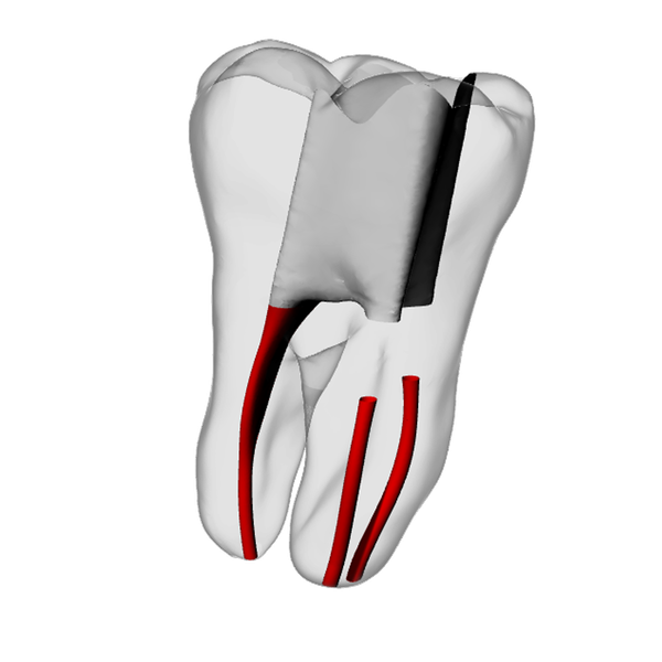 Molar – Obliterated