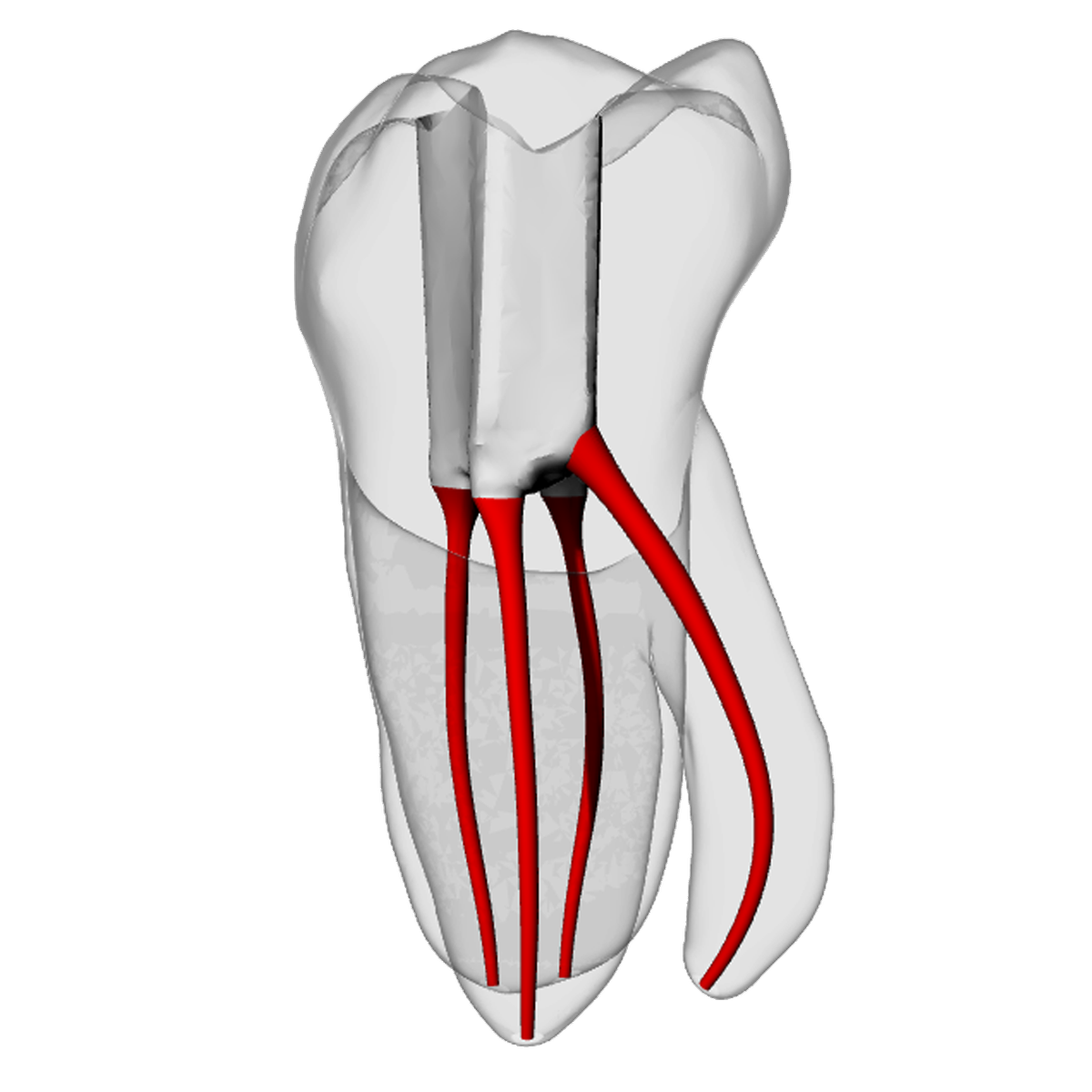 Molar – Radix entomolaris – DRSK Group AB, Zubehör für Wurzelbehandlung