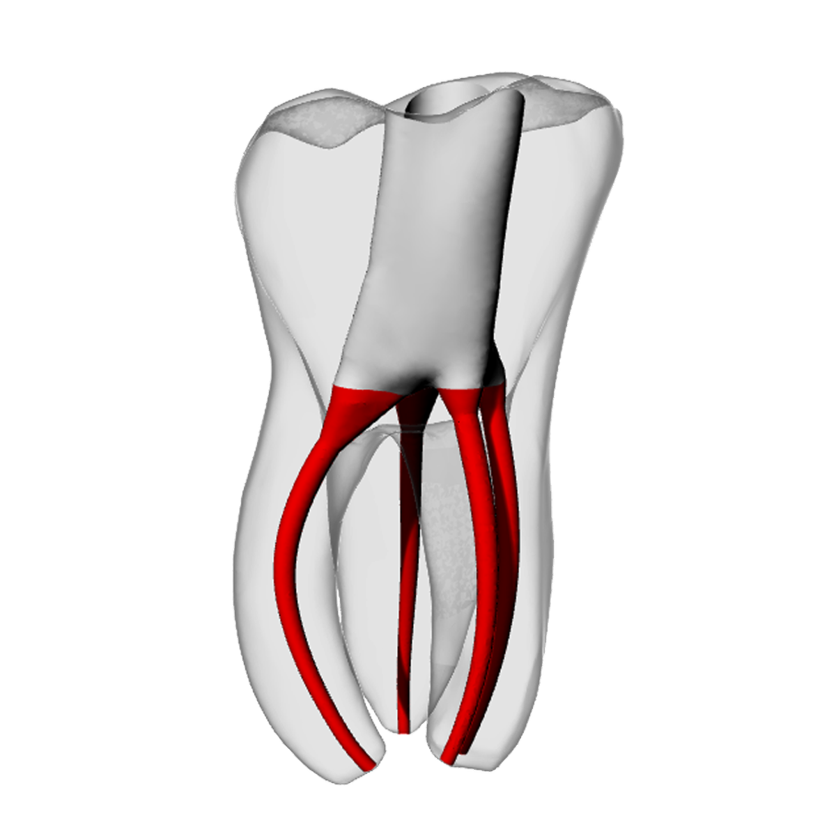 Molar – Accessed, MB2, Moderate Curvature – DRSK Group AB, Gipszusätze, Stumpflacke und Gipslöser