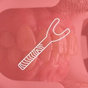 Lippenretraktoren – FOTODENTAL, Lupenbrillen und Mikroskope