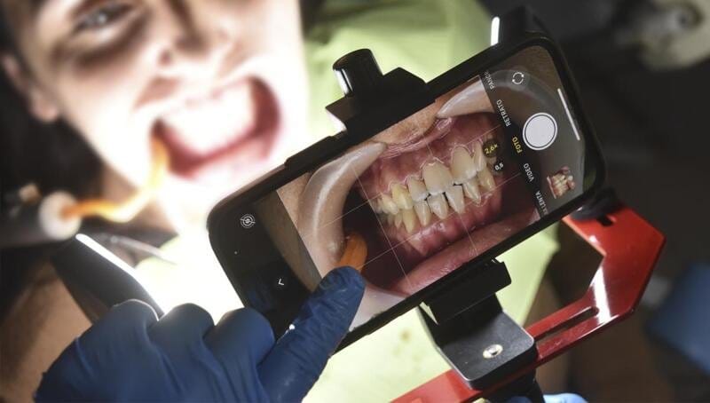 Fotodental Smartphone-Beleuchtungsgerät – FOTODENTAL, Intraorale Kameras