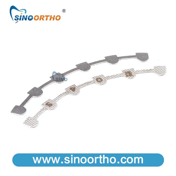 SINO ORTHO Orthodontic Lingual Retainer – Sino Ortho Limited, Kieferorthopädie