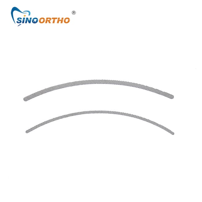 Lingual Retainer – Sino Ortho Limited, Kieferorthopädie