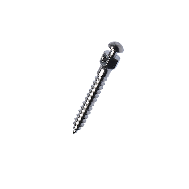 Orthodontic Implants China – Sino Ortho Limited, Verankerungssysteme