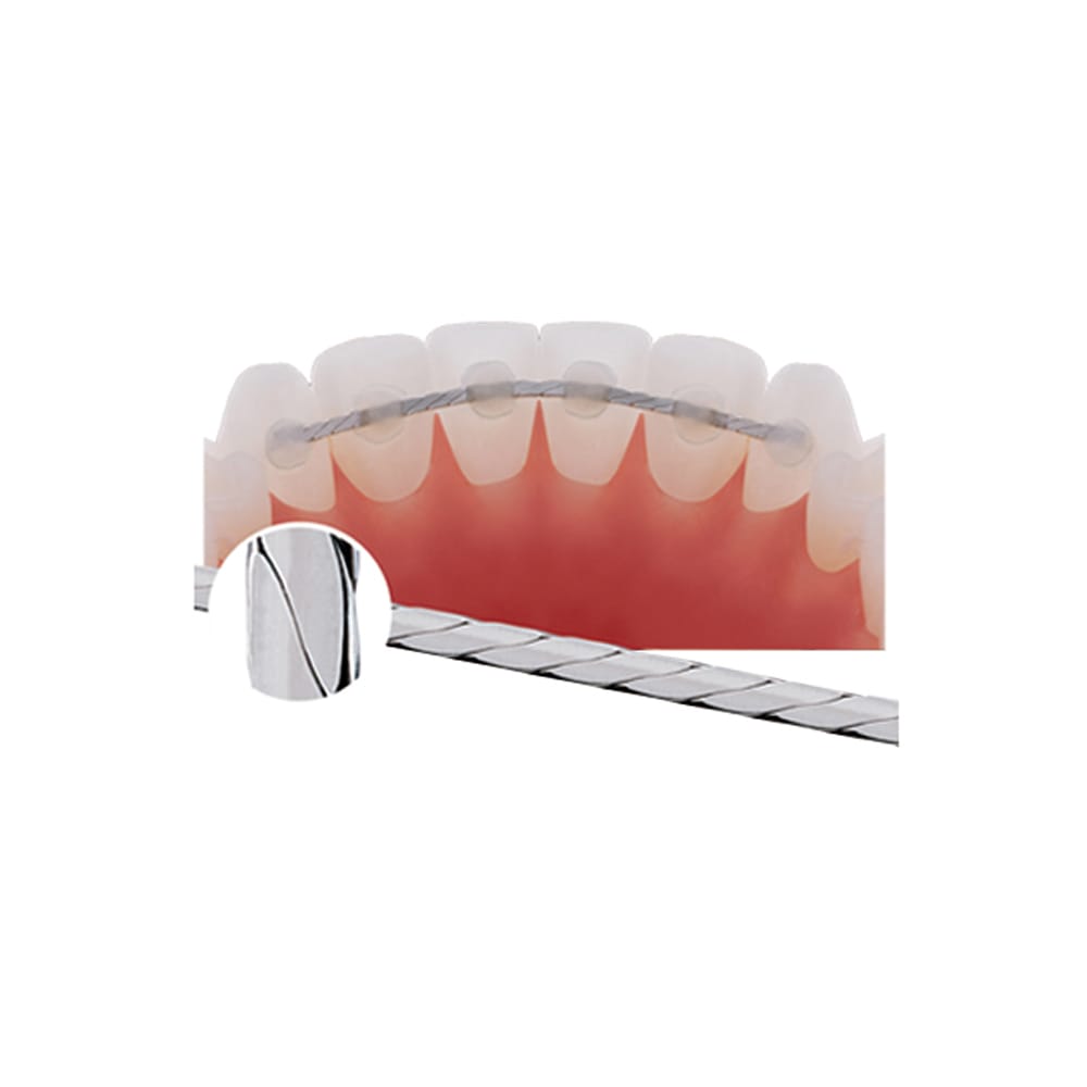 Braided Retainer Wire BRW – Sino Ortho Limited, Retention