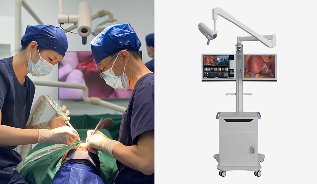 4K/HD Solution – Shanghai PAX Medical instrument Co.,LTD, Intraorale Kameras