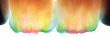 ceraMotion Zr 8-Farben-Kit – DENTAURUM, Keramikmassen