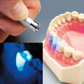 AG-3 ZEF Modellzähne aus fluoreszierendem Material für Prüfungen – Frasaco, Gipszusätze, Stumpflacke und Gipslöser