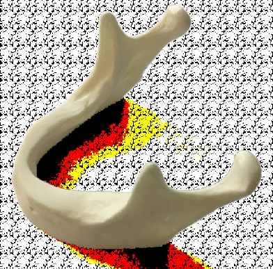 Anatomisch geformte einfache Mandibula – Navadha Enterprises, Implantologie