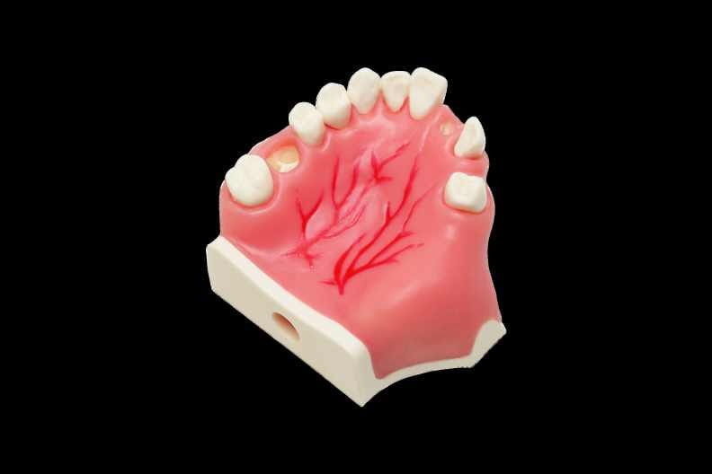 Modell für Implantatinsertion mit Sinussepten – Navadha Enterprises, Implantologie