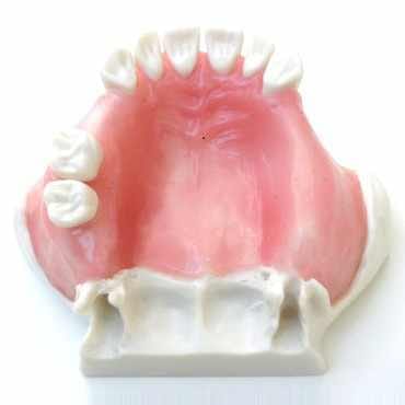 Sinuslift-Modell mit weichem Gingivaersatz