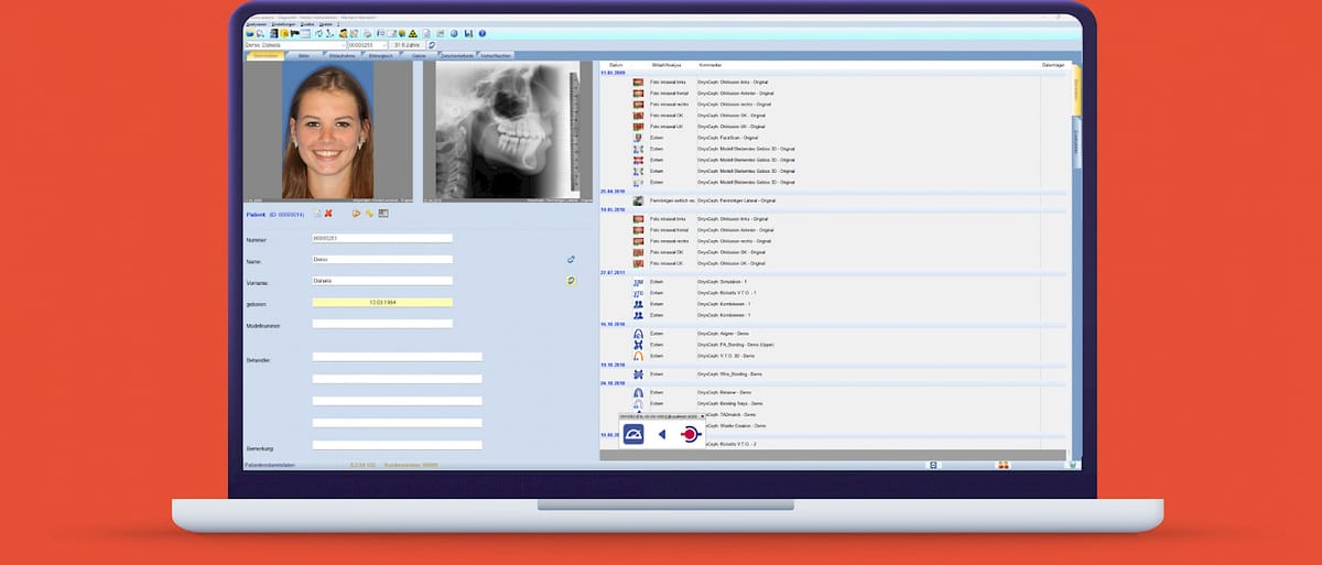 ivoris® analyze connect – Computer konkret, CAD/CAM-Software