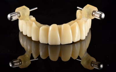 Remount Guide – Krausz Dental Lab, Bohrschablone