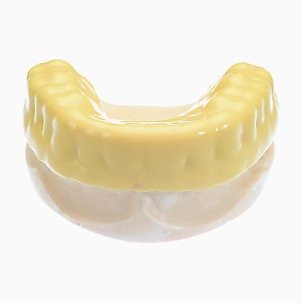 Custom Mouthguard I 100136