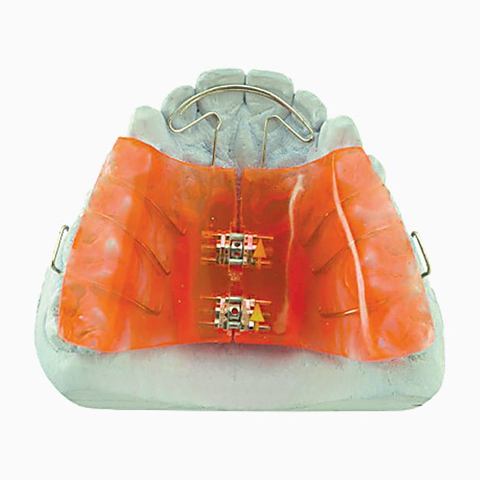 Transverse Expander EX/05 – lab3d, Sonstige Schienen