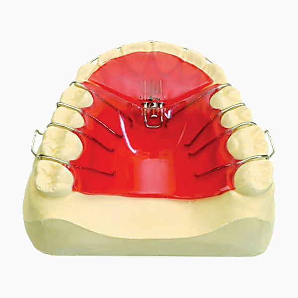 Sagittal Arch Expansion EX/08