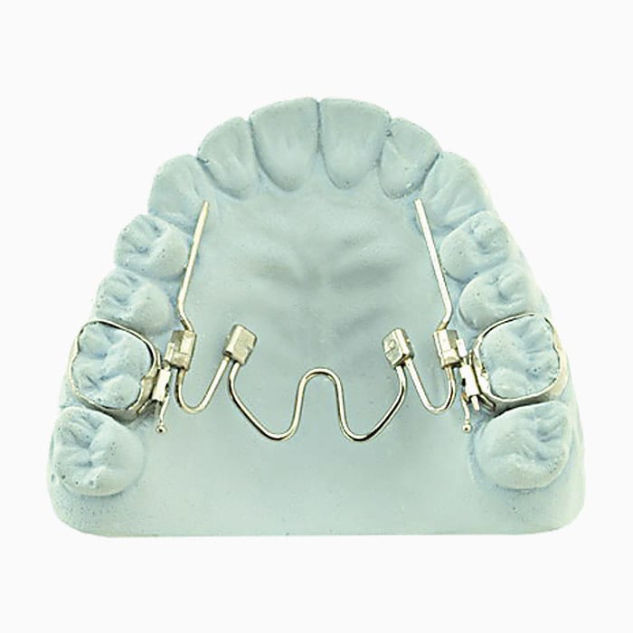 Nitanium Palatal Expander EX/17 – lab3d, Klasse-II-Apparaturen