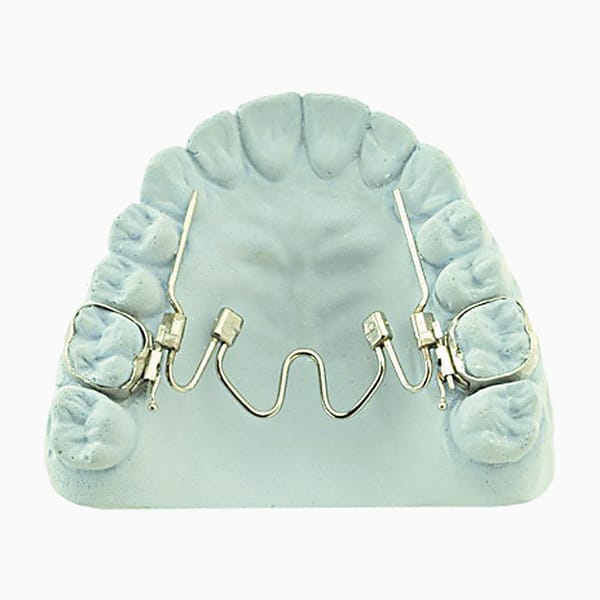 Nitanium Palatal Expander EX/17