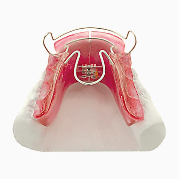 Standard Bionator III (To Open Bite) FA/03