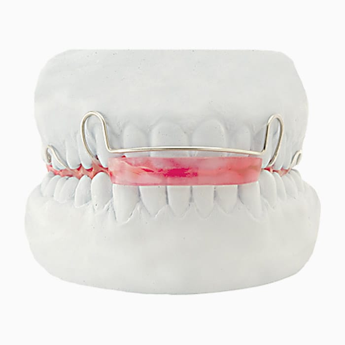 Lsu Activator For Deepbite Class II FA/08 – lab3d, Klasse-II-Apparaturen