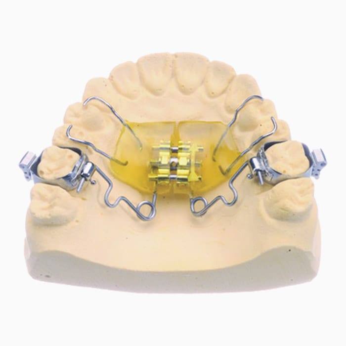 Hilger Pendex MD/07 – lab3d, Sonstige Schienen