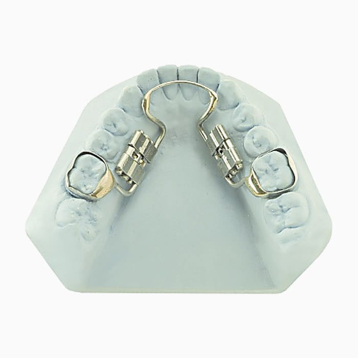 Lower Screw Driven Distalizer MD/13 – lab3d, Sonstige Schienen