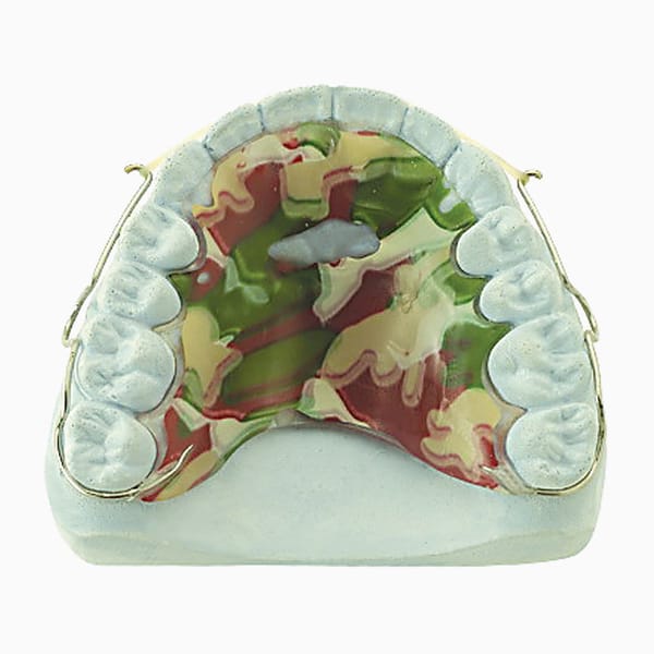 Minor Diastema Closing Retainer MD/15