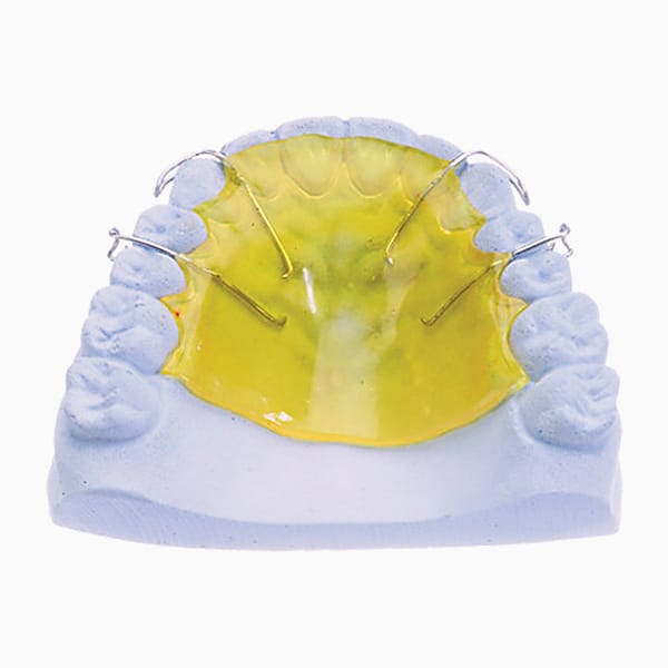 Retainer By Ricketts RA/09