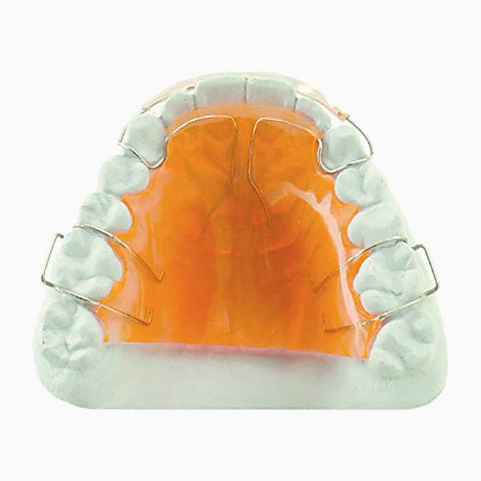 Removable Retainer RA/10 – lab3d, Retention