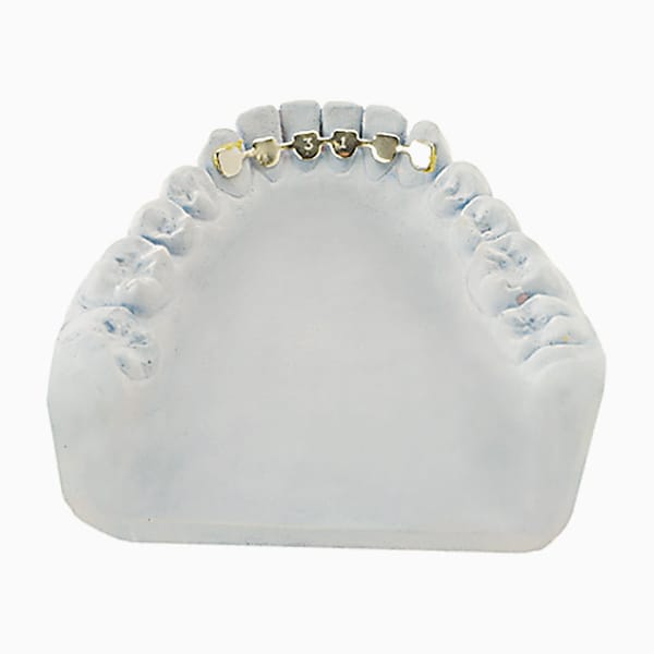 3x3 Fixed Retainer RA/12