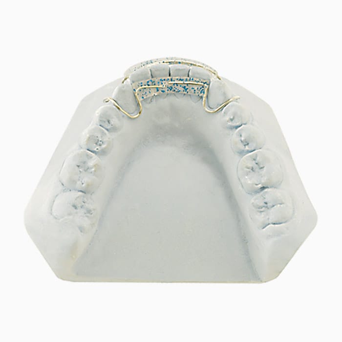 3x3 Spring Aligner RA/03 – lab3d, Sonstige Schienen