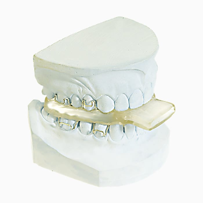 Napa Appliance SN/01 – lab3d, Schnarchtherapie